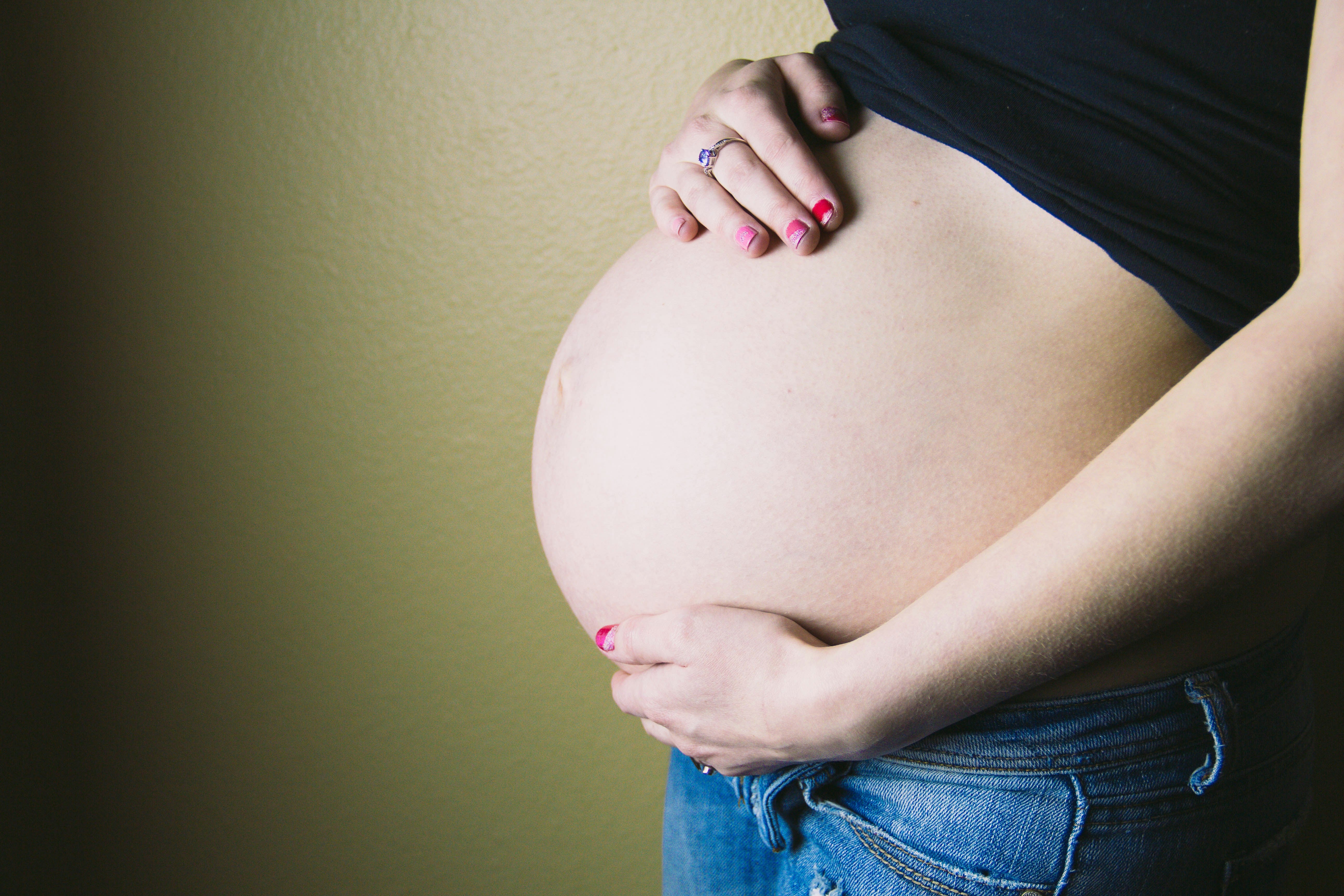 Stretch Marks and Tallow: The Natural Solution You Might Not Have Tried